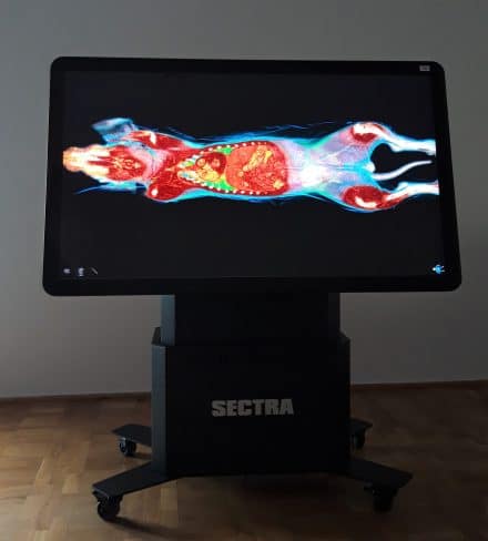 SECTRA - wirtualny stół anatomiczny