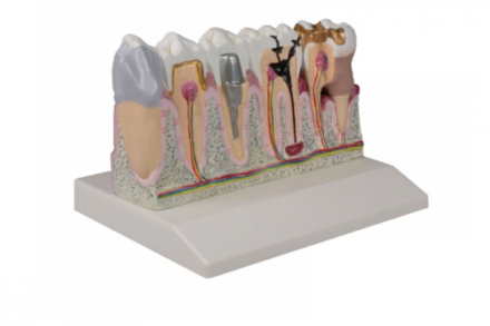 Model zębów