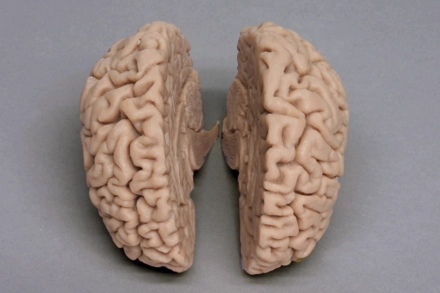 Model mózgu- odlew