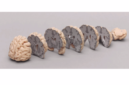 Model mózgu w przekrojach czołowych