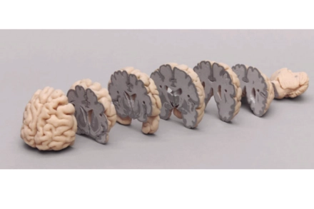 Model mózgu w przekrojach czołowych