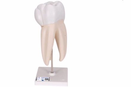 Model zęba – górny trzonowiec, (3 części)