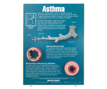 Tablica edukacyjna – astma