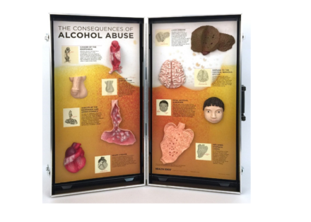 Tablica edukacyjna – konsekwencje nadużywania alkoholu
