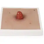 Realistyczny model ileostomii na podstawie