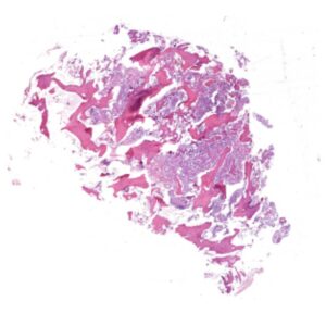 Histopatologia