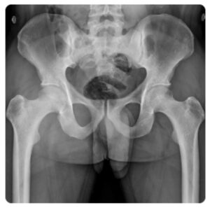 Radiologia